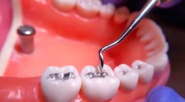 پین دندان چیست؟