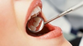 آینه دندان پزشکی چیست-چه کاربردی دارد؟